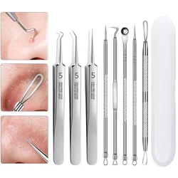 German Ultra-fine Cell Pimples Blackhead Clip Tweezers Remover Beauty Salon Scraping Closing Artifact Acne Needle Face Care Tool