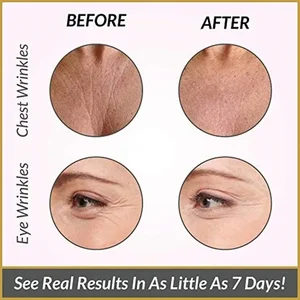 أفضل 8 مبيعا طقم ملصقات مضاد للتجاعيد - No6