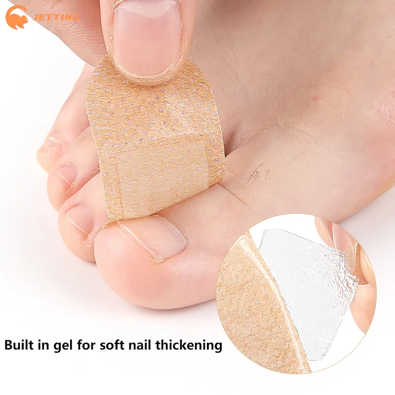 Patchs pour ongles des pieds, 32 pièces, tissu Non tissé Non irritant et respirant, bandes polyvalentes pour soins des pieds