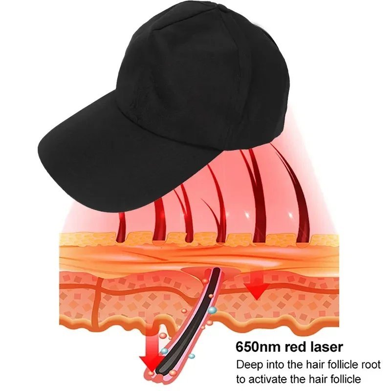 

Portable Laser Hair Loss Treatment Machine Cap Type Phototherapy Equipment with Fast Shipping