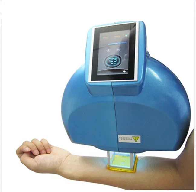 Excimer Lazer 308nm Vitiligo Lazer Phototherapy Device Portable Vitiligo Treatment Machine Vitiligo Treatment Laser Devices