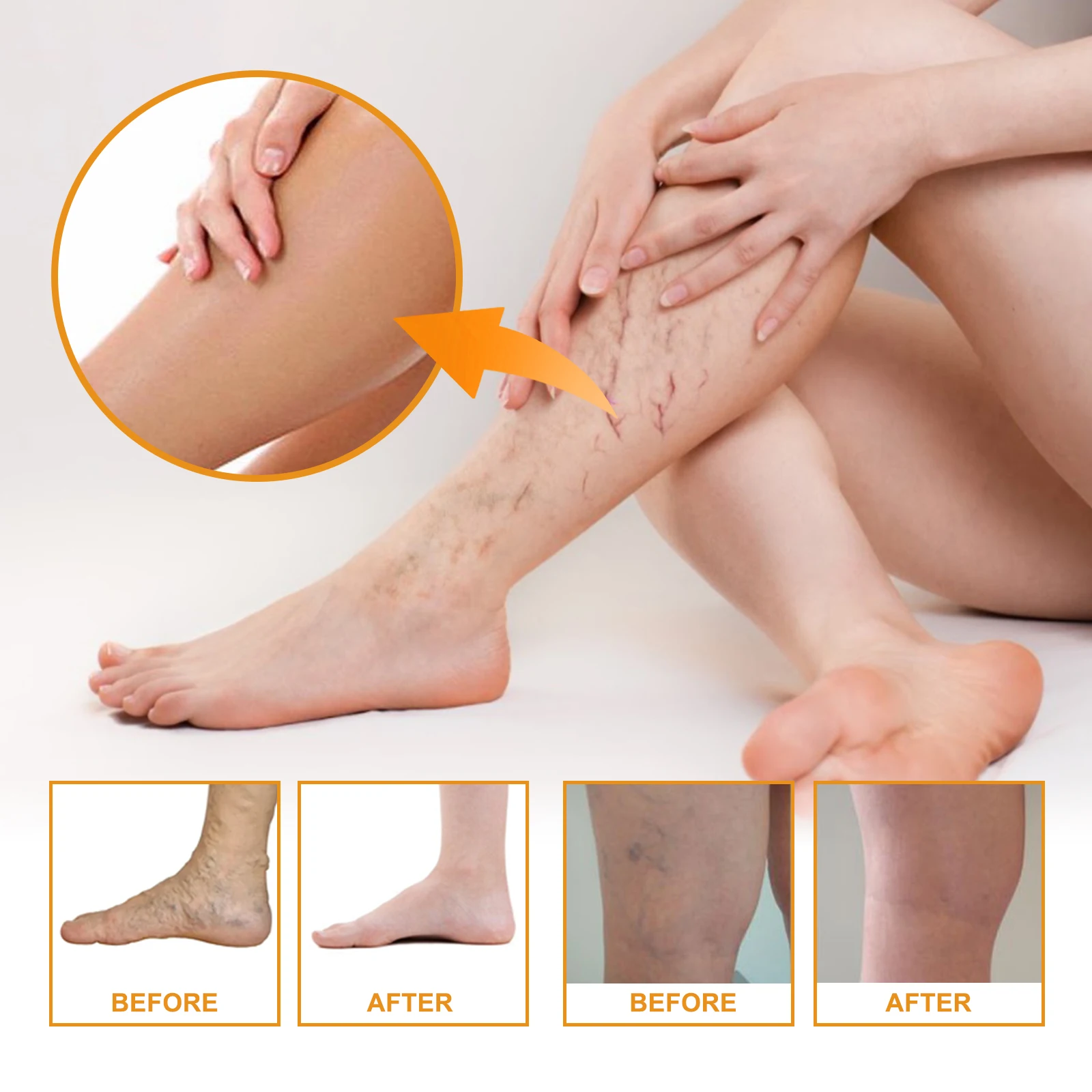 EELHOE Vitamin K Cream Herbal Medicine Vein Massage Care Relieve Leg Soreness and Swelling Earthworm Leg Skin Care Cream