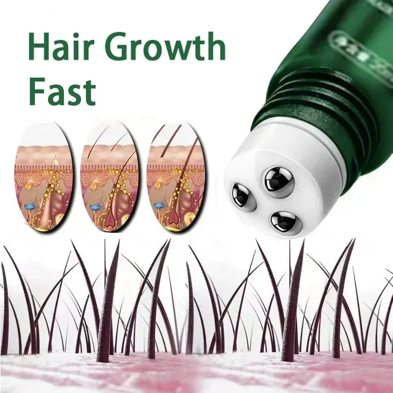 Hair Growth Oil Fast Growth Effective Baldness Repair Hereditary Postpartum Loss Seborrheic Hair Loss