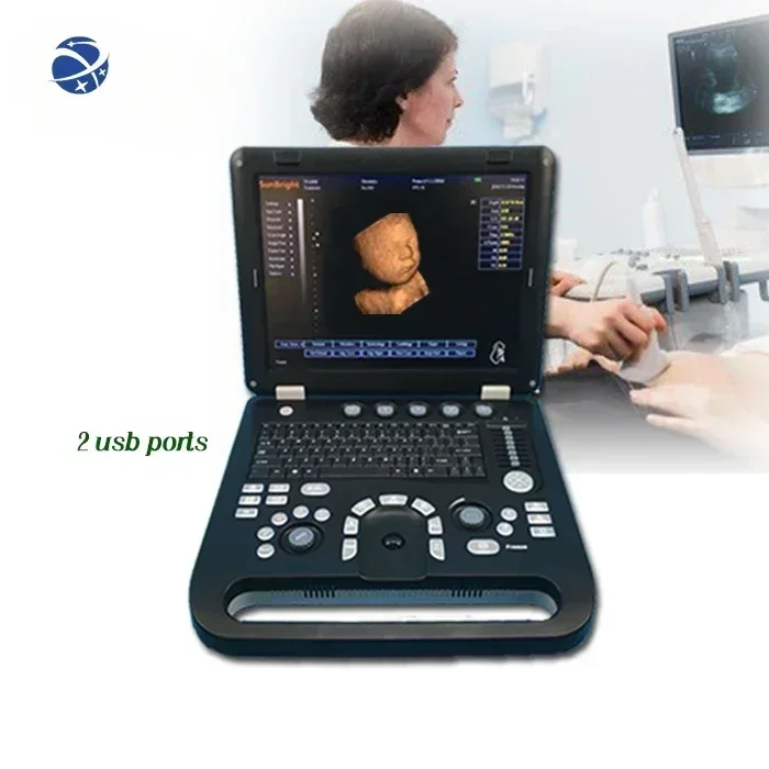 Portable USG 4D ultrasound machine Laptop color 3D digital ultrasound