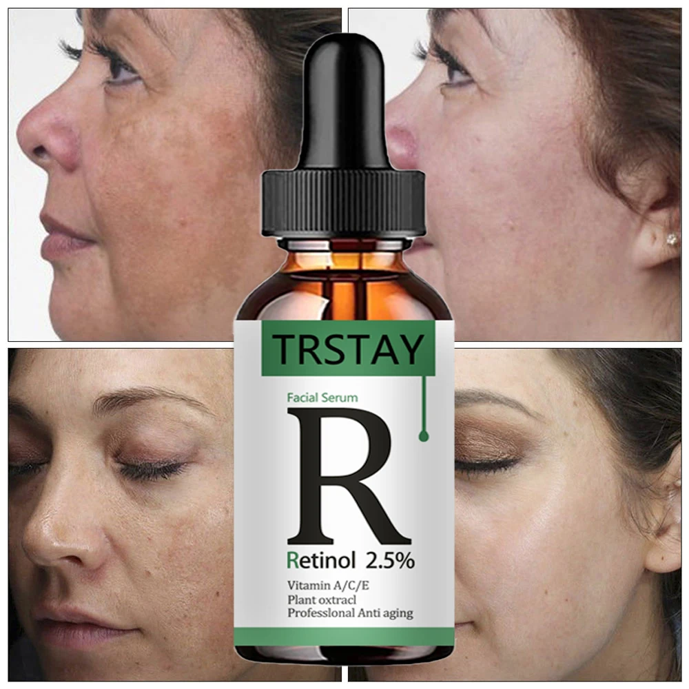 retinol 2.5% vitamin C/A facial essence reduces fine lines, tightens skin, and improves damaged skin