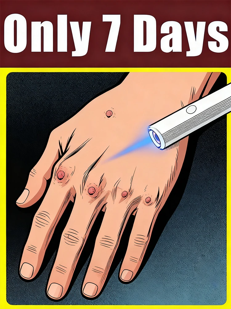 

Innovative cold light technology effectively removes wₐᵣₜₛ, eliminating them at the root