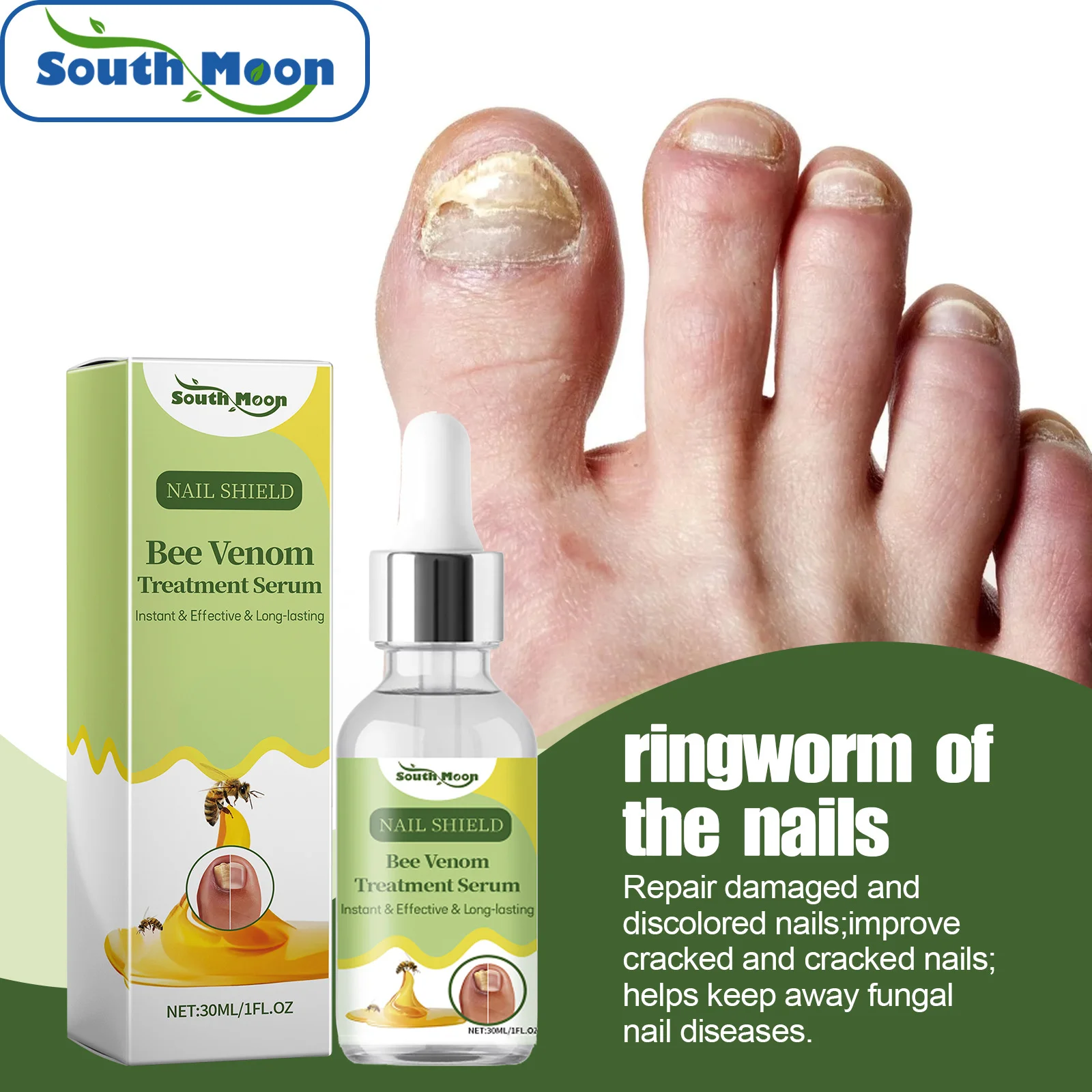 

Bee Venom Nail Care Serum Fungal Nail Treatment Hand Foot Paronychia Onychomycosis Removal Anti Infection Nail Repair Essence