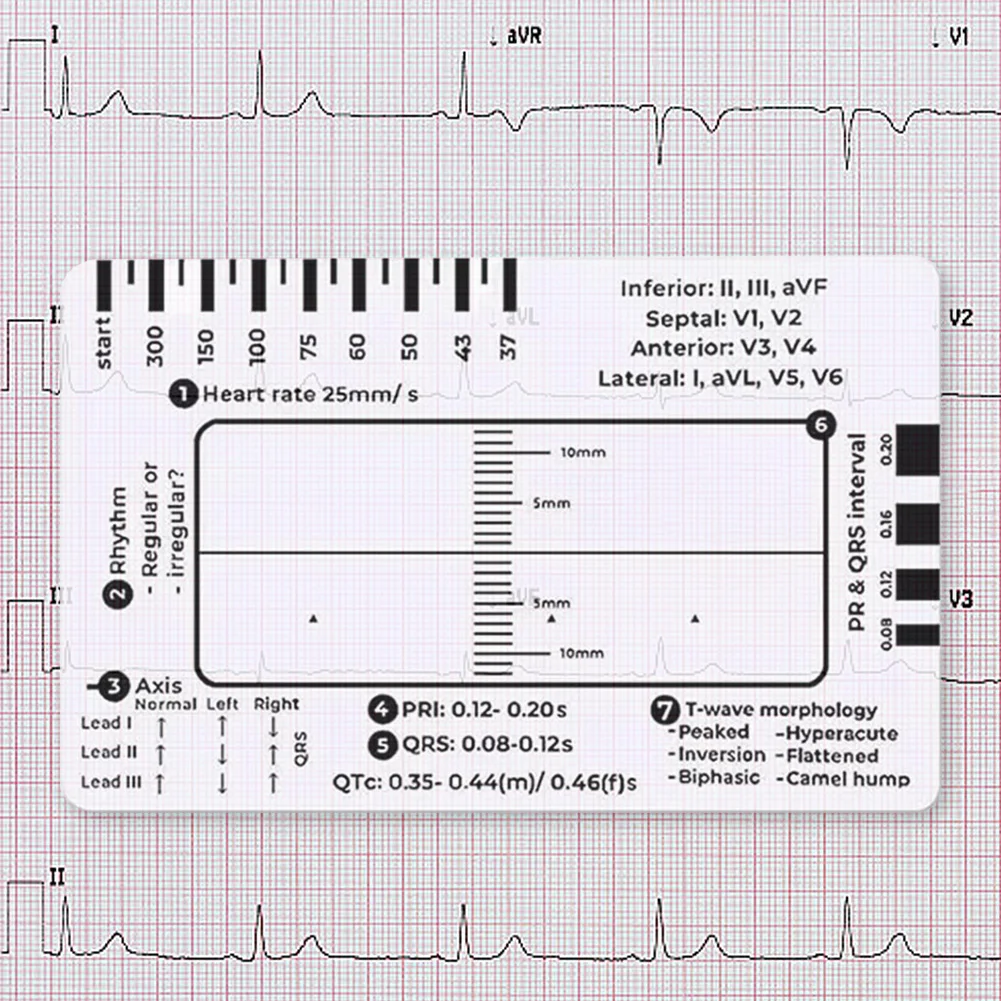 

7-ступенчатая линейка Ecg, 7-ступенчатая линейка Ecg, портативный карманный штангенциркуль ЭКГ ЭКГ с защитной оболочкой, инструмент для оценки