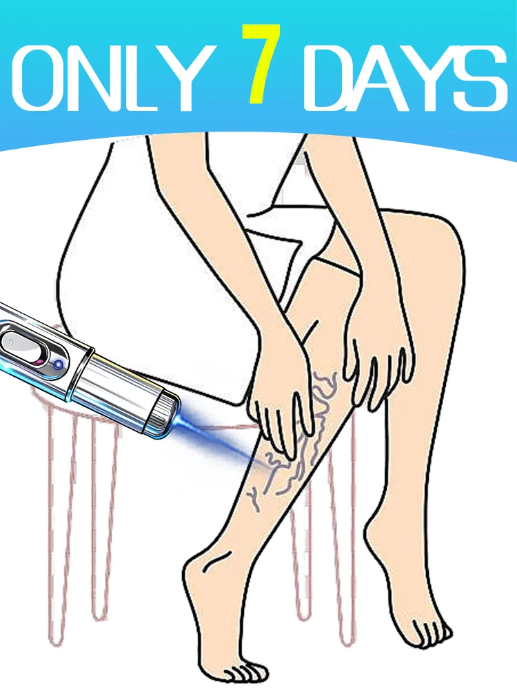 

Blue laser pen 2nd generation Helping people solve problems. About your legs.