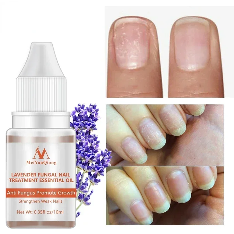 Weichmacher für getrocknete Blumen, Behandlung von Nagelhautöl, nahrhafte Gel-Nagellack-Nagelhaut, Nagelkunstwerkzeug, Nagelpflegeöl, 1 Flasche