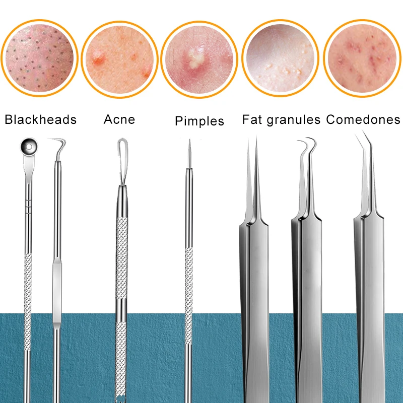 블랙헤드 핀셋 블랙헤드 코메돈 바늘, 여드름 여드름 추출기, 블랙헤드 제거 도구 클리너, 얼굴 스킨 케어 도구