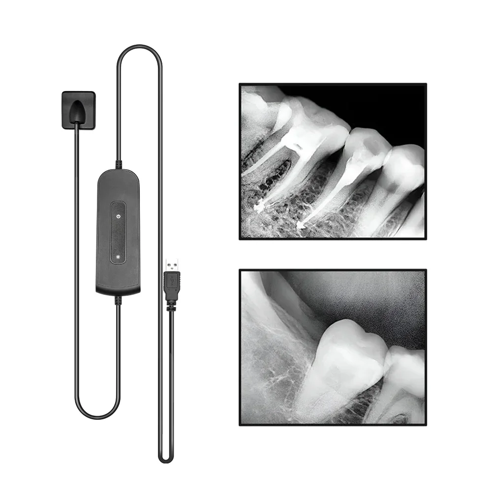 Dental Sensor X-Ray Dentistry High-Frequency Rx Digital Intraoral Digital System H D Image Radiovisografo Dental Digital Sensor