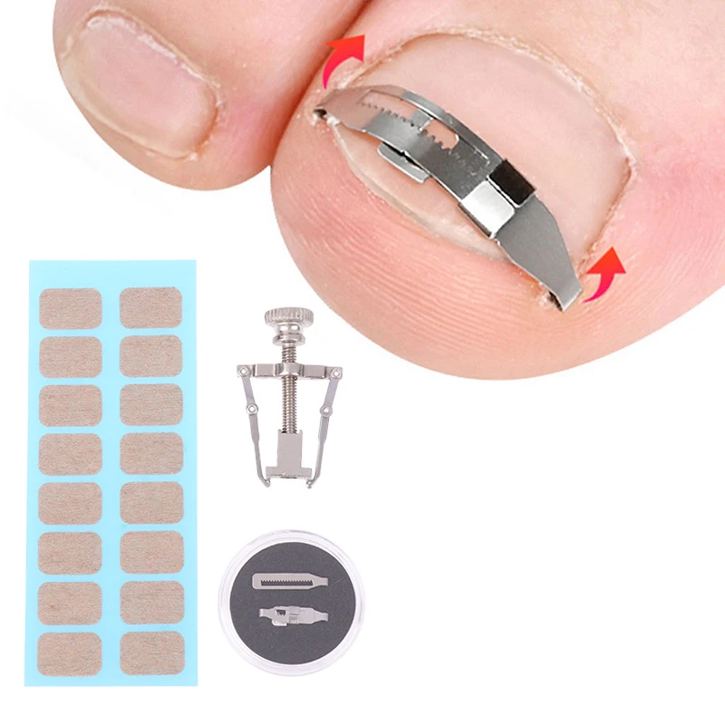 Narzędzia do korekcji wrastających paznokci Pedicure odzyskaj osadzanie paznokci u stóp leczenie profesjonalna pielęgnacja stóp narzędzie do korekcji pielęgnacja stóp