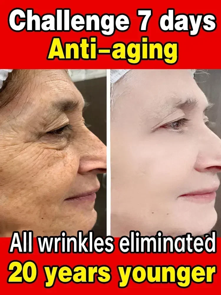 Effective anti-ageing and anti-wrinkle facial serum to remove facial wrinkles fine lines around the eyes crow's feet neck wrinkl