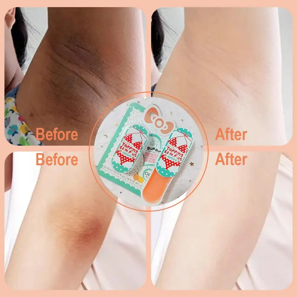 

30g Whitening Body Cream Private Parts Underarm Bleaching Knee Butt Intimate Dark Thigh Parts Brighten Inner Remove D4K6
