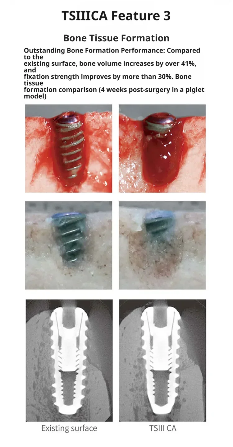 Osstem TSⅢ CA Hydrophilic Implant Fixture, CA Calcium Activated Surface for Rapid Bone Healing Dental Surgical Instrument