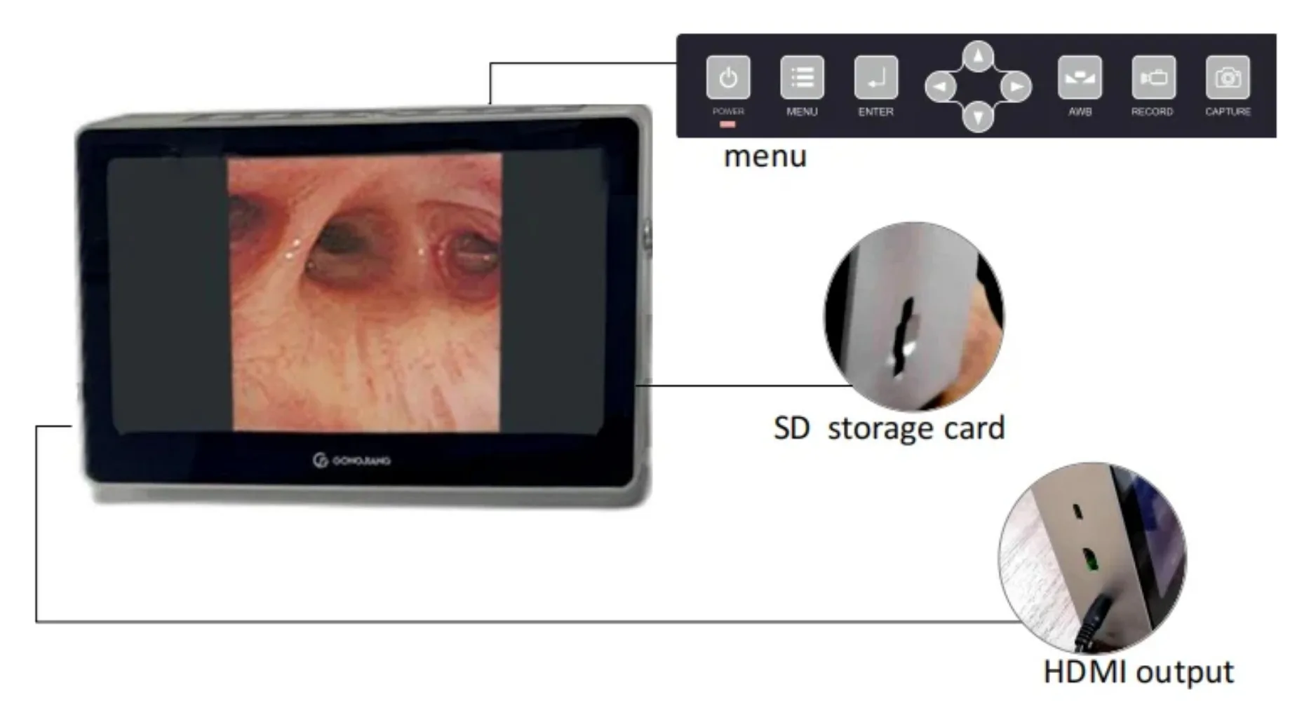 Portable Multifunctional Veterinary Endoscopy System, Veterinary Bronchoscope
