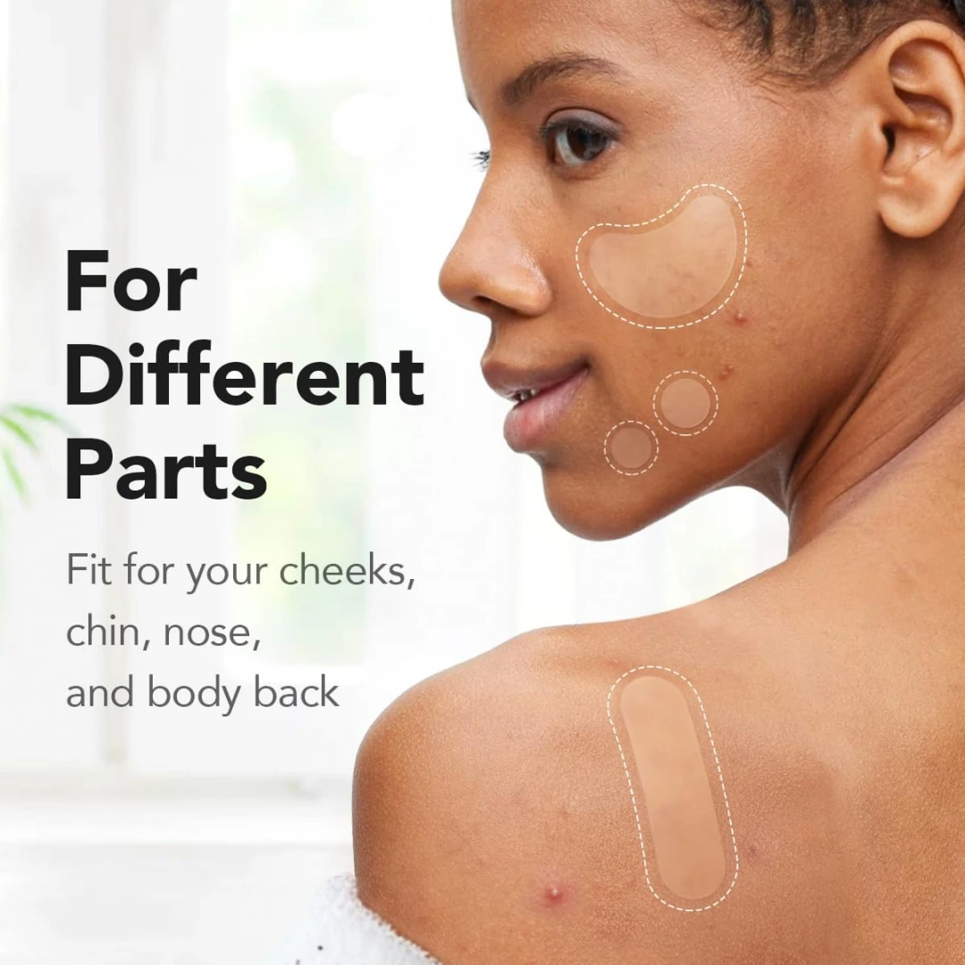 204 قطعة XL غير مرئية حب الشباب القشرة مقطوع ملصق تقليل حب الشباب التطهير المسام إزالة النفط إصلاح والبشرة الناعمة منتجات الوجه Var
