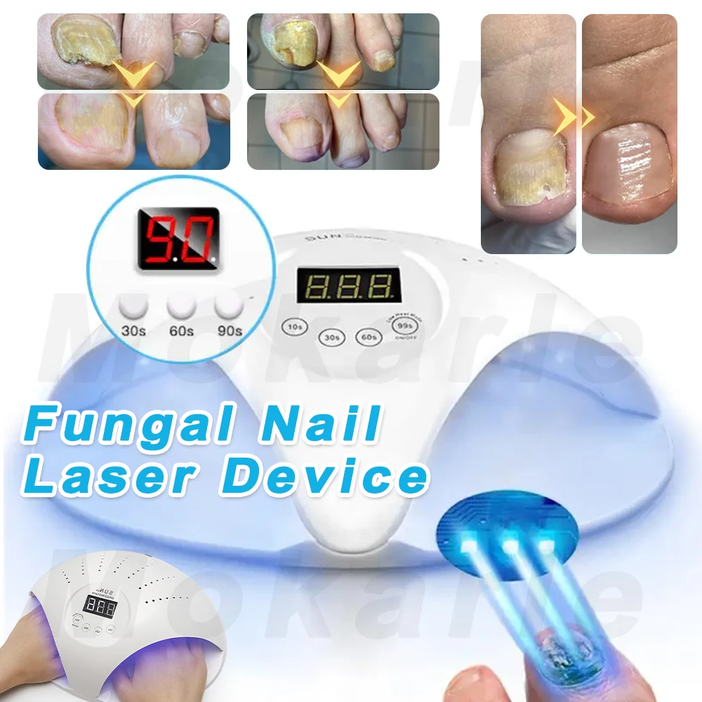 2-In-1 Fungal Nail Laser Device Repair Fast Nails Fungus Onychomycosis Repair Toenail Fingernail Removes Nail Fungus Foot Care