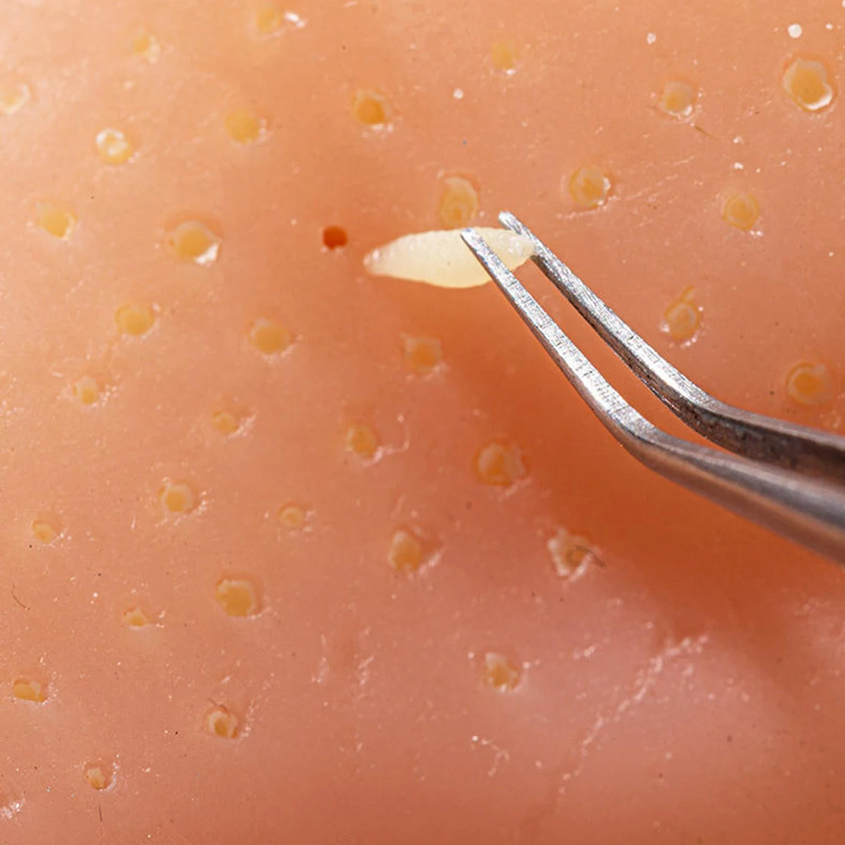 ของเล่นบีบคลายเครียด รูปทรงสตรอว์เบอร์รี บีบสิว จำลองการบีบสิว ของเล่นตลก ช่วยลดความเครียด ทำความสะอาดสิวเสี้ยน