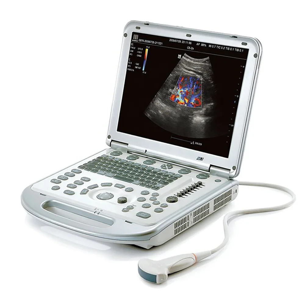 M7 Mindray Professional Portable 3d/4d Color Doppler Ultrasound Machine