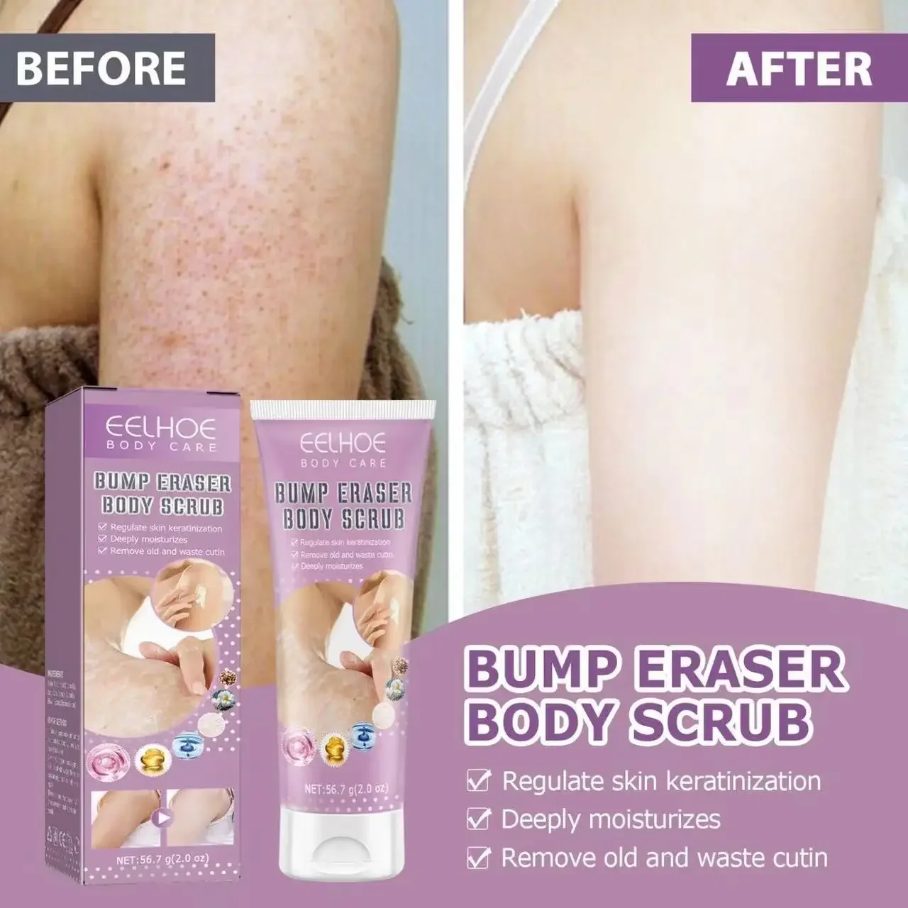 Keratosis Pilaris Cream For Strawberry Legs Removal KP Bump Eraser Body Scrub Remove Chicken Skin Improve Smooth Care Product