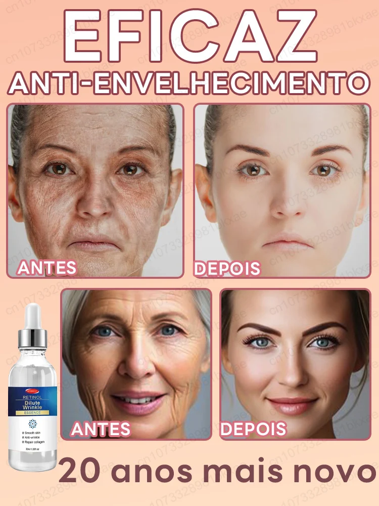 [Magia antienvejecimiento] Esencia antiarrugas levanta y reafirma para eliminar líneas finas y bolsas para los ojos