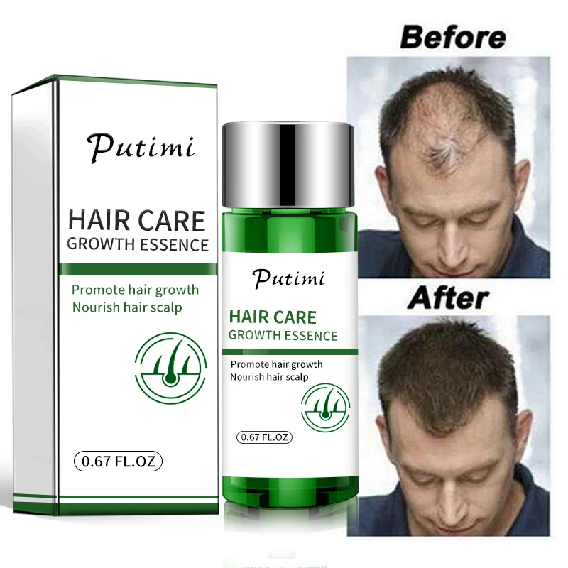 Soro do crescimento do cabelo para homens e mulheres, 30ml, produto natural do cuidado do cabelo para impedir a perda e o cabelo danificado, tslm1