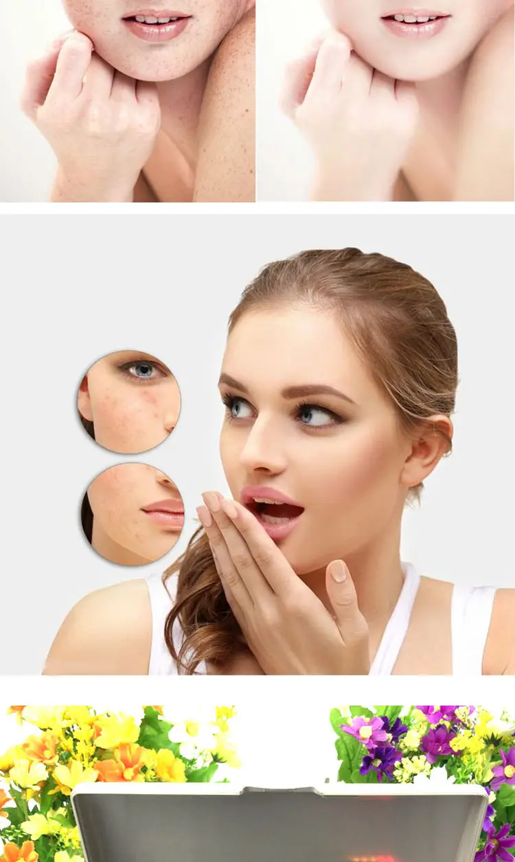 Stylo spécial pour salon de beauté, enlève les grains de beauté et les taches de rousseur, livraison gratuite