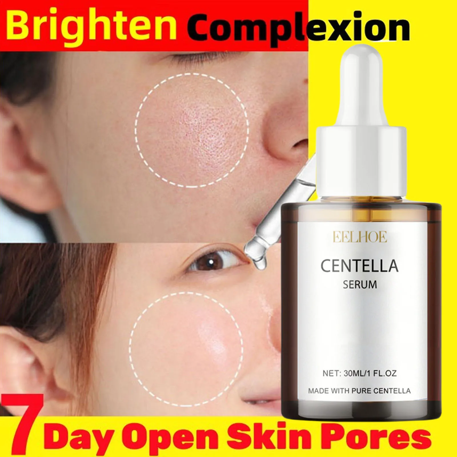 

Centella Toner Serum Shrink Pore Deep Moisturize Fade Smile Lines For Sensitive Skin Acne Remove Face Care Lotion Korea Cosmetic