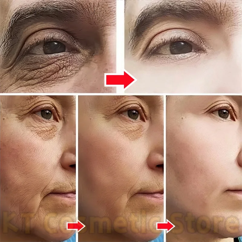 

Retinol Anti-Wrinkle Eye Cream Stick Serum Capsules Collagen Fade Nasolabial Folds Firming Face Skin Moisturizing Brightening