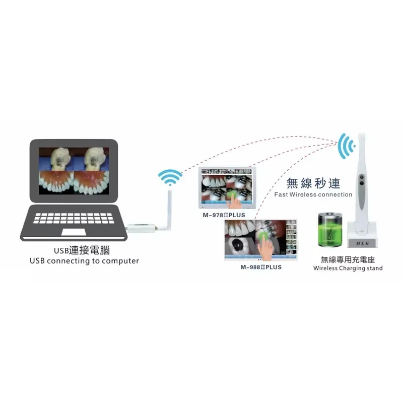Hot Sale Hot Sale Intelligent 5G Wireless Endoscope Electric-powered Oral Camera Scanner Waterproof Pressure-Resistant