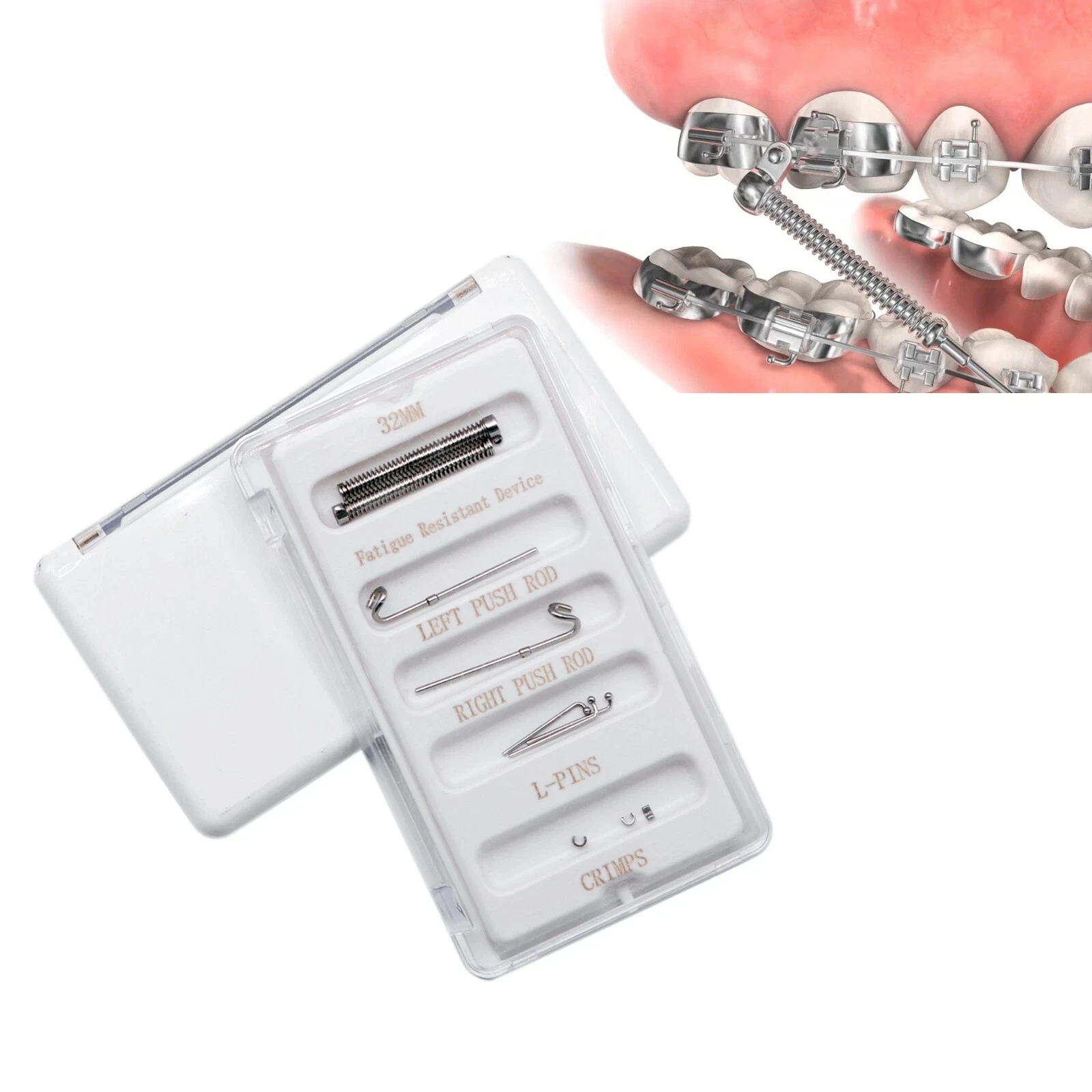 Orthodontic Class II Corrector Fatigue Resistant Device Push Rod 22-38mm Forsus