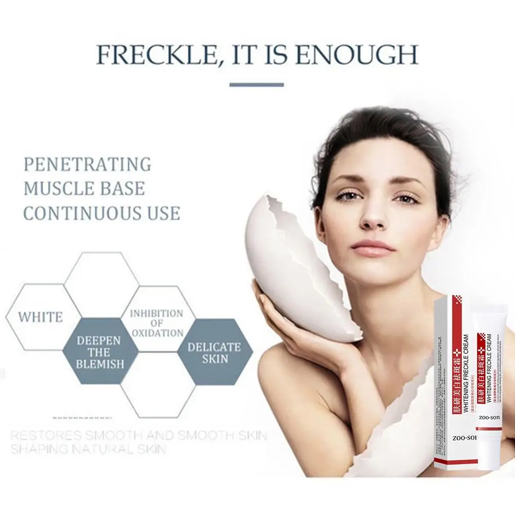 Effective Whitening Freckle Cream Remove Dark Spots Anti Freckle Cream Fade Pigmentation Melasma Brighten Creams Skin Care 20g