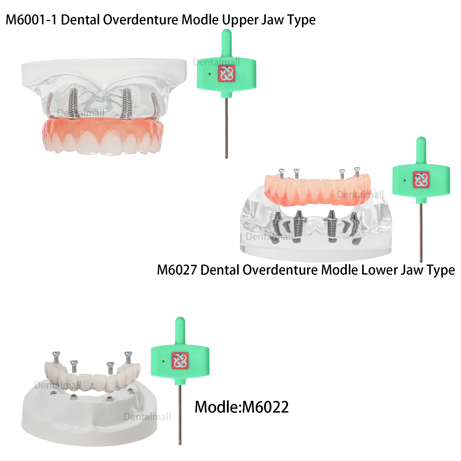 

Dental Teeth Model Upper Jaw Lower Jaw Typodont Overdenture Practice Type Model Implant Restoration Model Demo