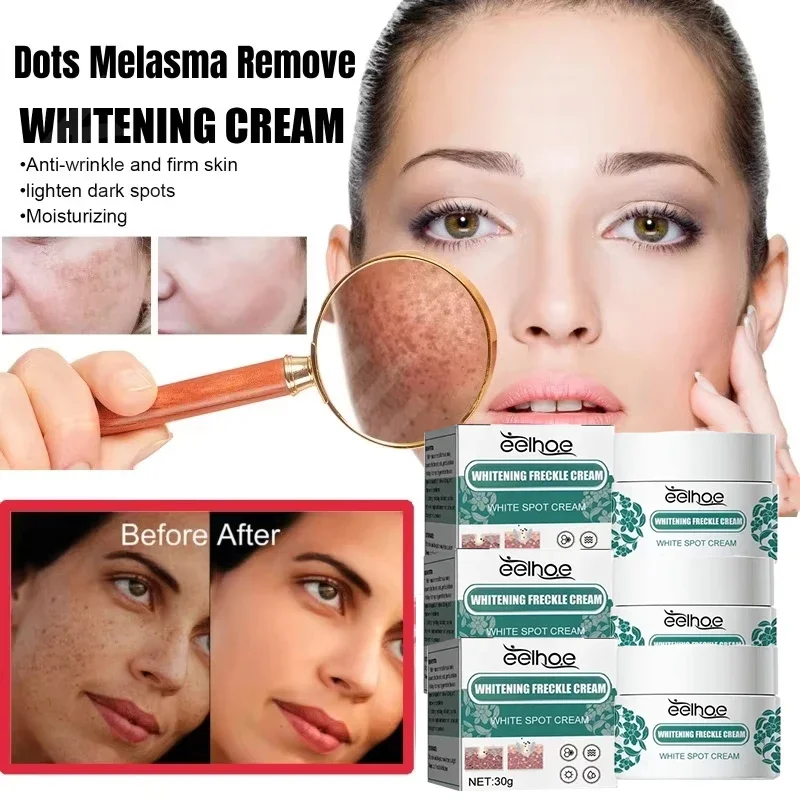 Whitening freckle removing Cream Reduces Melanin Brightens Facial Cream Lightens Dull Skin Fine Lines Facial Care Serum