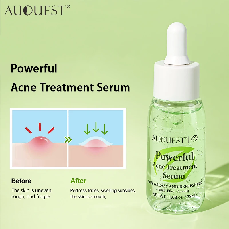 AUQUEST ácido salicílico tratamiento del acné suero Facial Control de aceite a base de hierbas desvanece marcas de acné eliminador de espinillas cuidado de la piel Facial