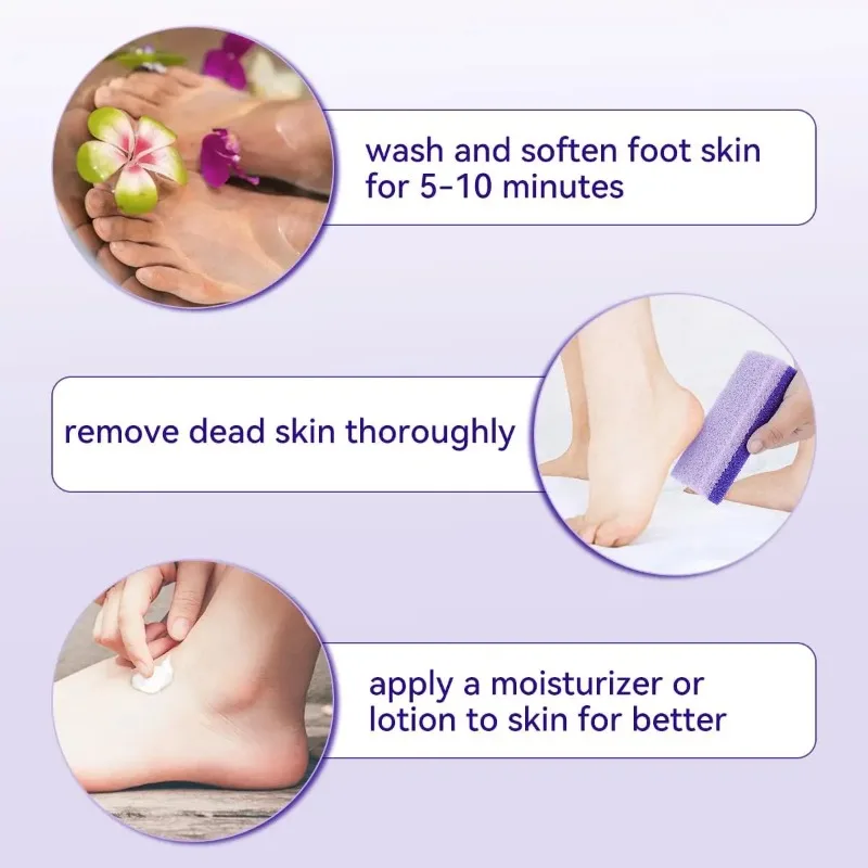 Thumbnail 2 - #10 Top 50 Pumice Stones Worth Buying In 2026