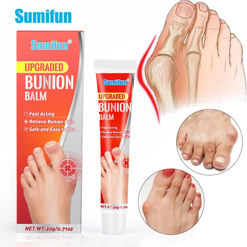 

20g Sumifun New Gout Bunion Treatment Balm Cream Hallux Valgus Pain Relief Ointment Toe Joint Feet Orthopedic Arthritis Plaster