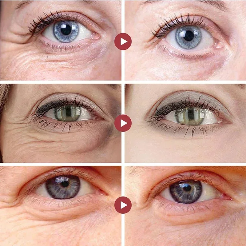 Crème démaquillante instantanée pour les yeux, rétinol, anti-déformable, lifting, raffermissement de la peau, décoloration, ligne fine, anti-cernes, poches, éclaircissant, soins