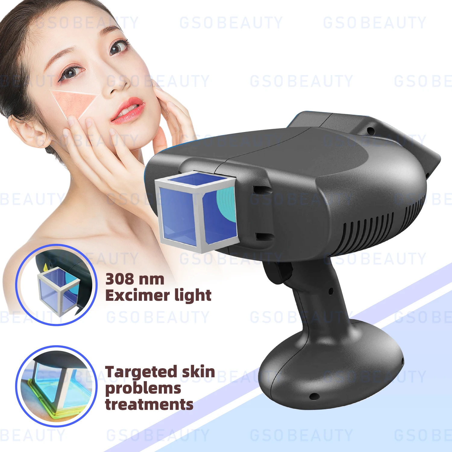 308nm Excimer Phototherapy Device for Skin Treatment UVB Free Cooling System with Adjustable Timer Professional Medical Device
