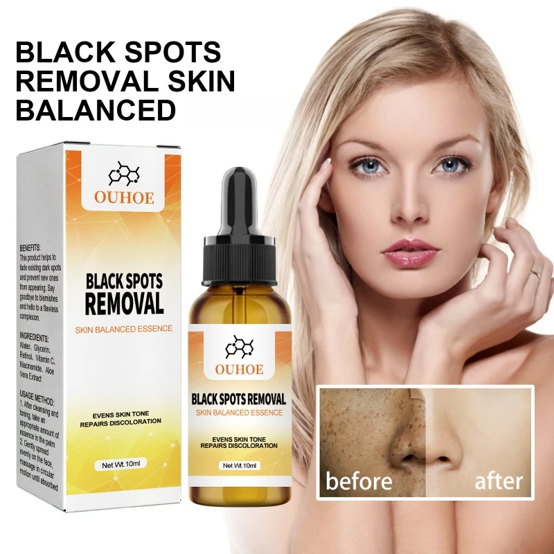 Haut Melanin Reparatur Essenz Haut Mattheit verblassen dunkle Flecken erhellen Hautton Sommersprossen Anti-Aging feuchtigkeit spendende Bleaching Essenz