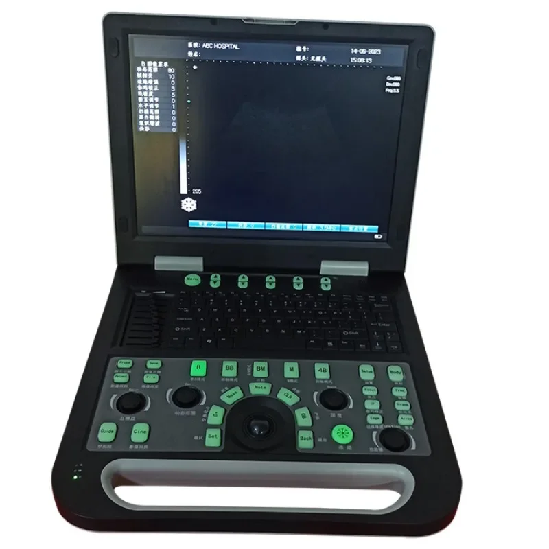 High definition veterinary ultrasound machine, portable color ultrasound machine, home pregnancy detection instrument
