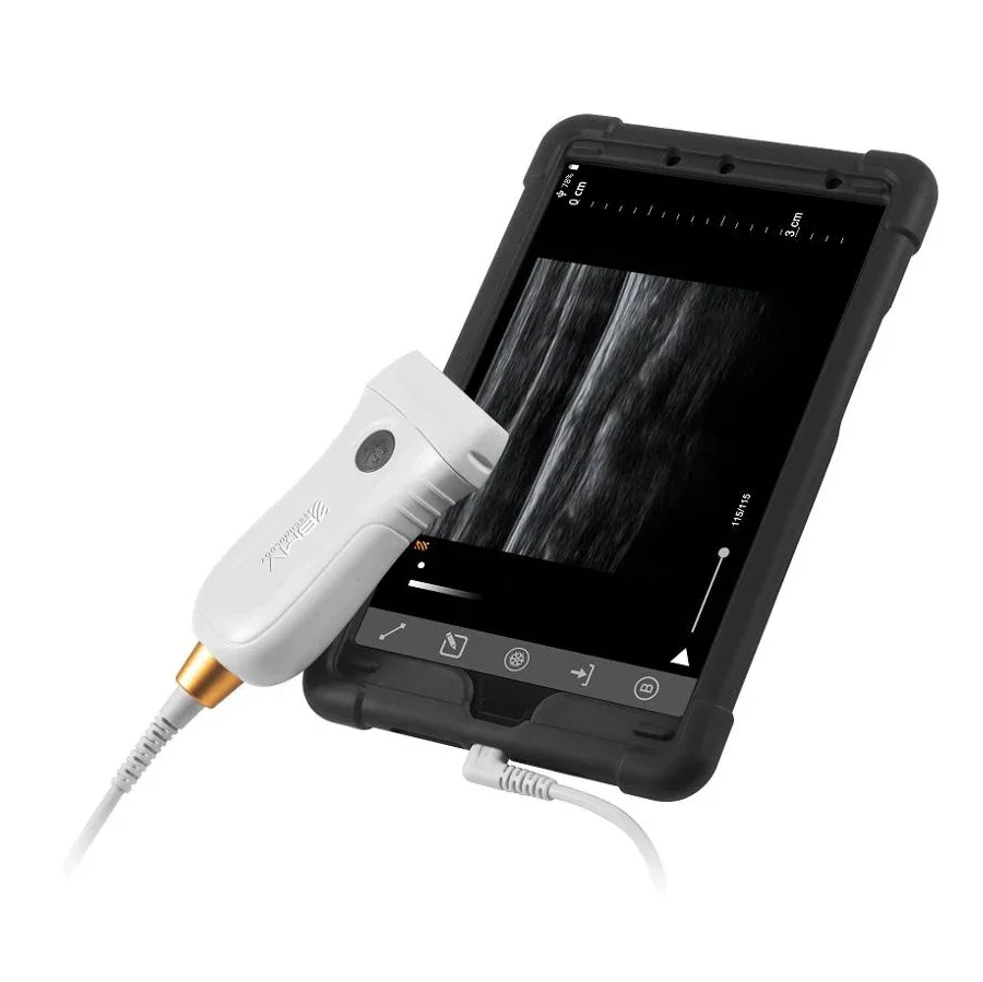 Higher Sensitivity Economic Portable Handheld Type C USB Equine Veterinary Ultrasound Probe