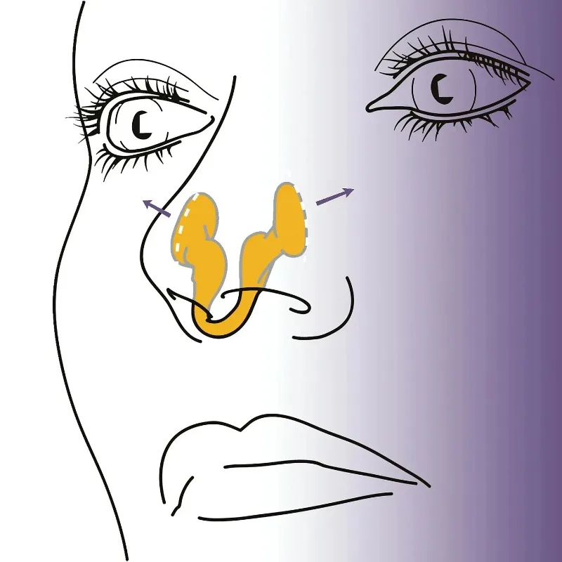 البرتقال 1 قطعة جهاز إيقاف الشخير الصغير سيليكون مشبك الأنف المرن مكافحة الشخير لوازم لمنع الشخير النوم الجيد