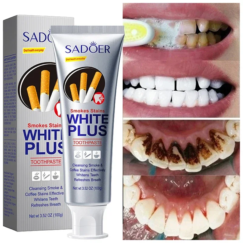 

Teeth Whitening Toothpaste Fast Remove Smoke Coffee Tea Stains Cleaning Oral Hygiene Plaque Fresh Breath Bleaching Dental Tools