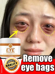 Remove bags Puffiness away work under eyes