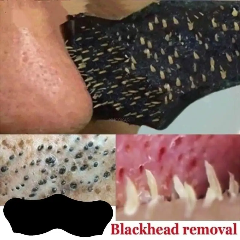 50 قطعة فحم الخيزران التطهير العميق الأنف ملصقات الرؤوس السوداء الأنف قناع حب الشباب مزيل الرؤوس السوداء الأنف البقع الوجه بقعة ملصقات