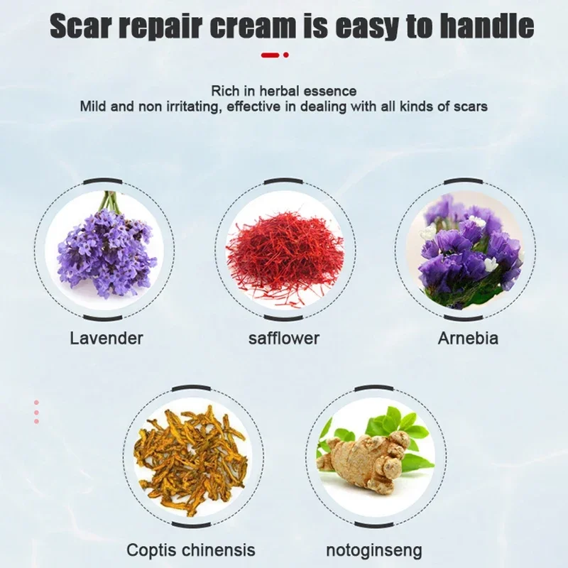 Scar Removal Cream Fast Remove Scars Effectively Treat Skin Surgery Scars Stretch Marks Acne Pox Prints Burn Scars Facial Gel