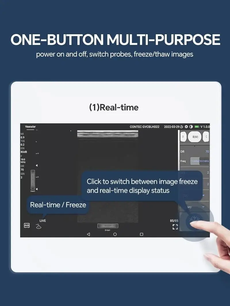 CONTEC handheld  Color Doppler ultrasound diagnostic system WIFI CMS1600 (3 iN 1 probe) Convex and Linear Probe, iOS/ Android